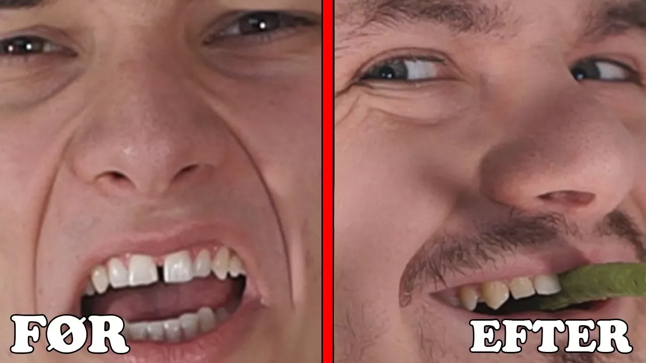 VI FIKSER VORES MELLEMRUM..