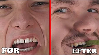 VI FIKSER VORES MELLEMRUM..