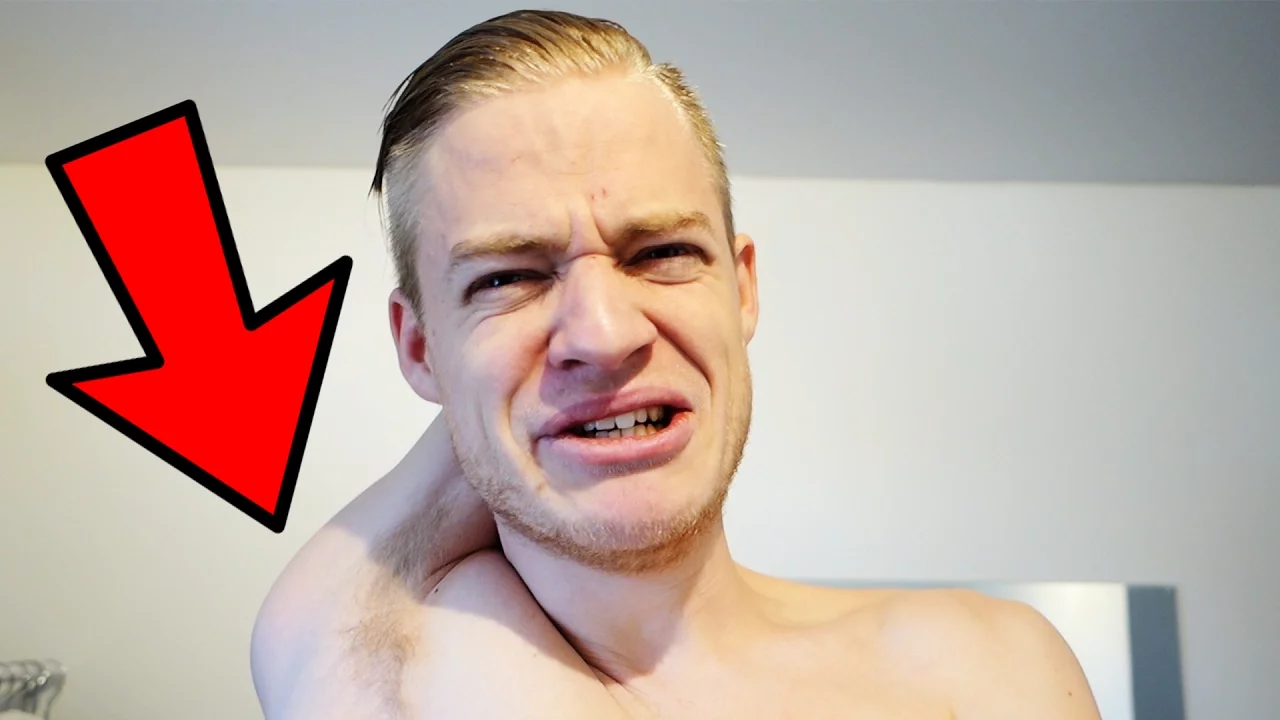 JEG HAR MISTET MIN ARM !!!!