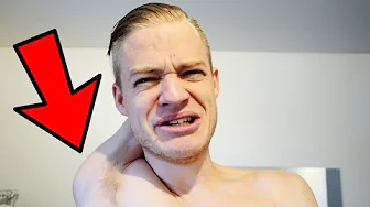 JEG HAR MISTET MIN ARM !!!!