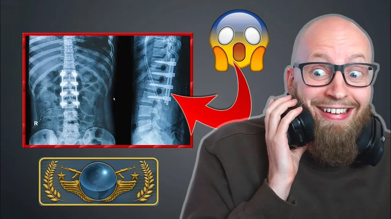 Ondt i ryggen! CS GO CARRY