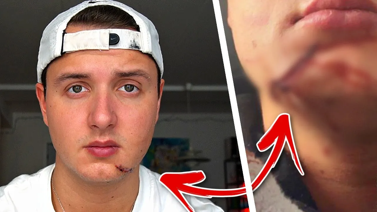 jeg har ødelagt mit ansigt..