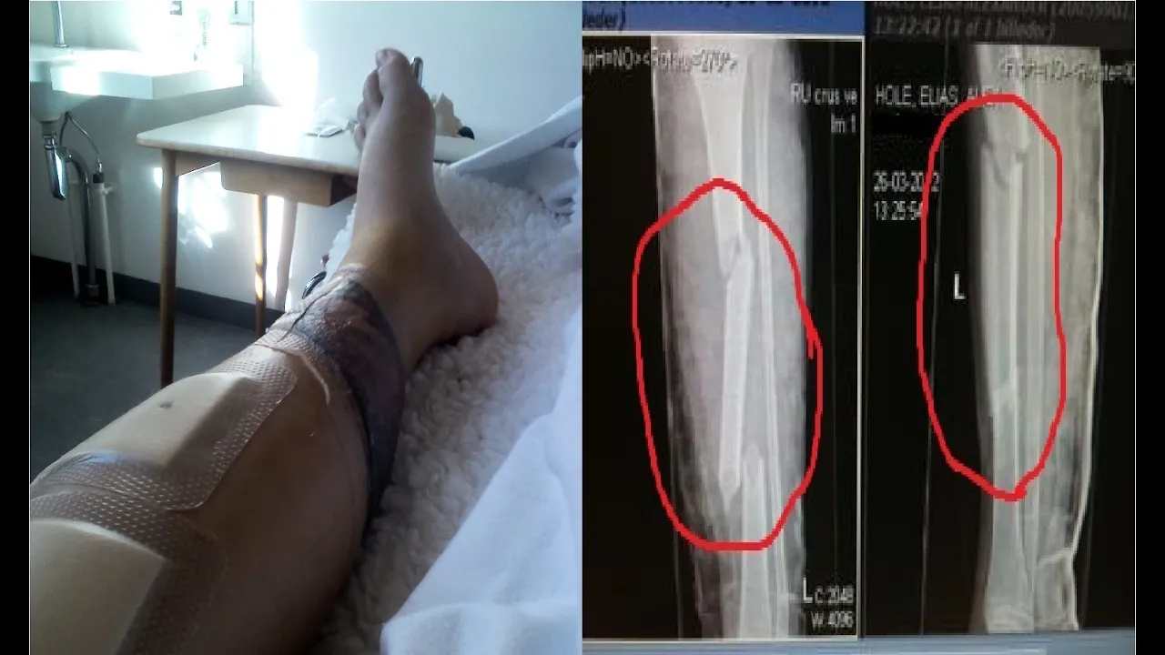 DENGANG JEG BLIV KØRT NED!!! - Det dummeste jeg har gjort!