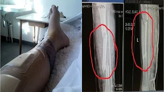 DENGANG JEG BLIV KØRT NED!!! - Det dummeste jeg har gjort!