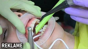 Lasse hos Tandlægen! | Vlog