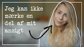 Jeg er født med en sygdom // Min historie