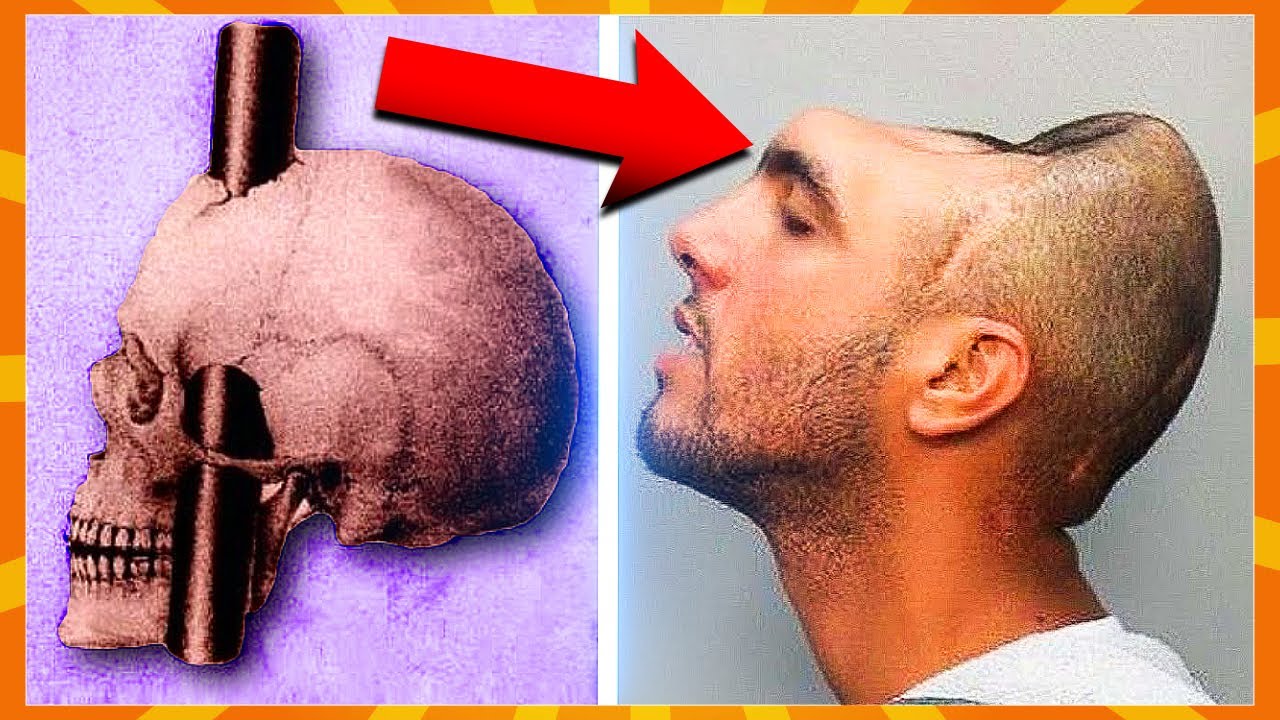 10 Personer Der Overlevede Det Umulige!