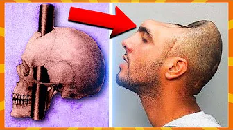 10 Personer Der Overlevede Det Umulige!