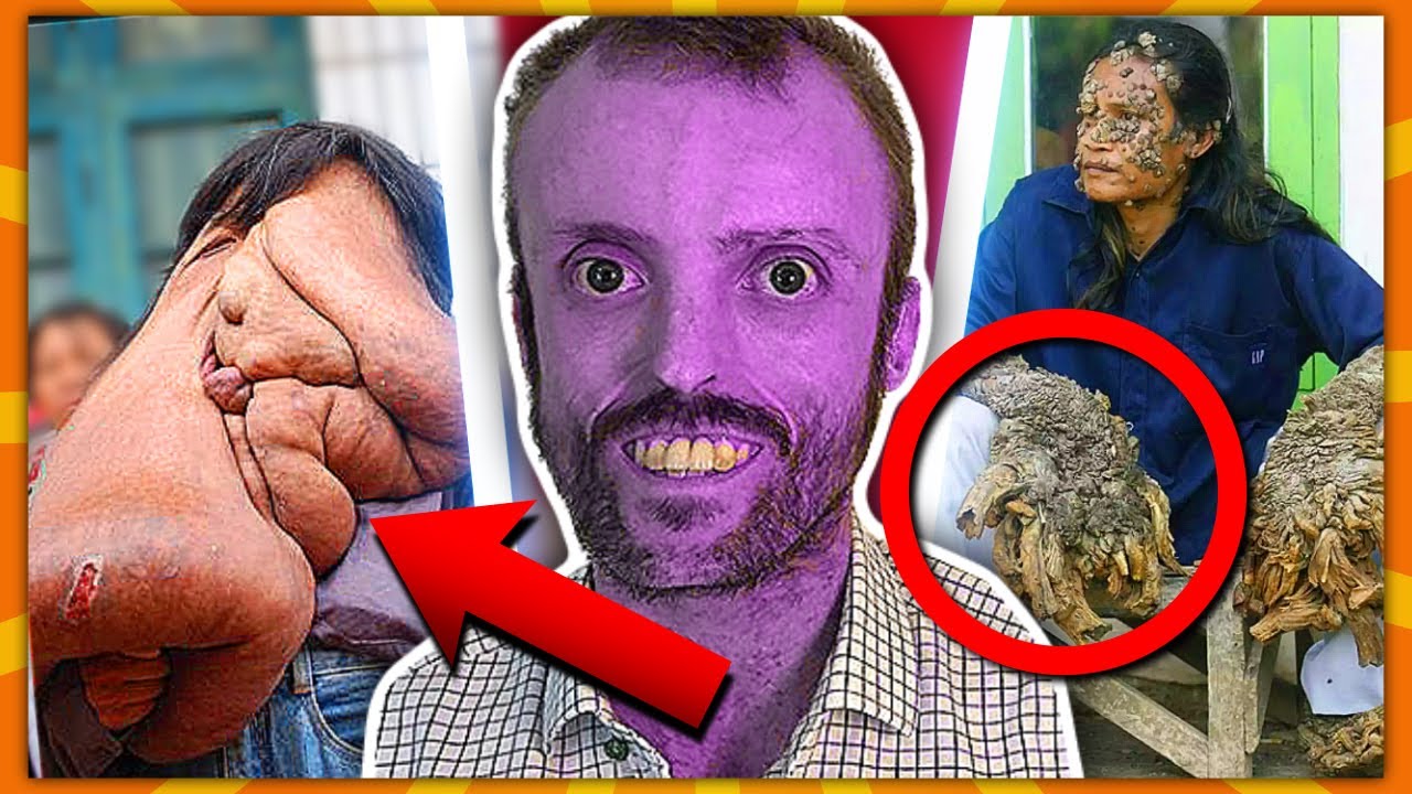 9 Meget Specielle Mennesker!