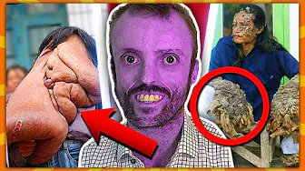 9 Meget Specielle Mennesker!