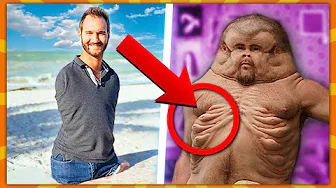 10 Mega Specielle Mennesker!