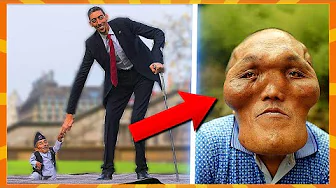 10 Meget Specielle Mennesker!