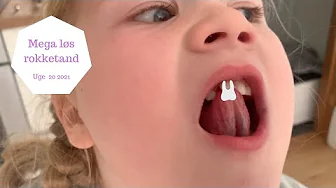 DEN VILDESTE ROKKETAND