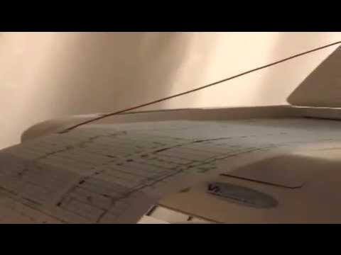 Zoe's way to the world - A girl is being made