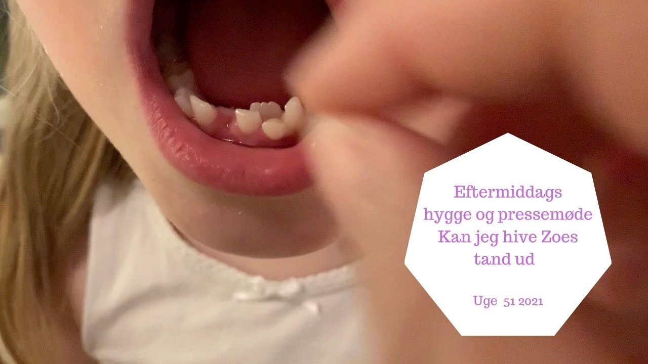 HYGGE EFTERMIDDAG OG PRESSEMØDE - KAN JEG HIVE ZOES ROKKETAND UD