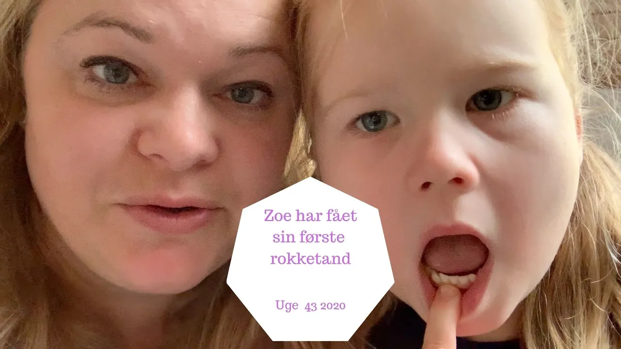 ZOE HAR FÅET SIN FØRSTE ROKKETAND - 5 ÅRIG FÅR EN ROKKETANFD