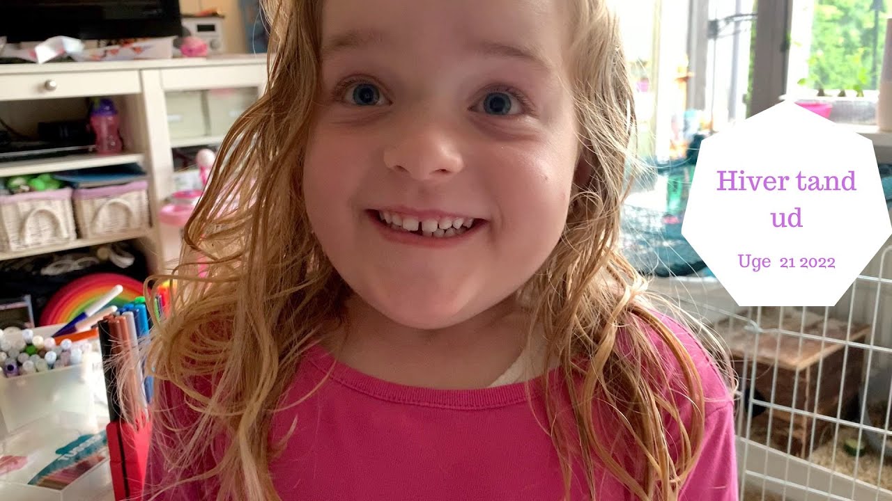 KAN VI HIVE HALEYS TAND UD?