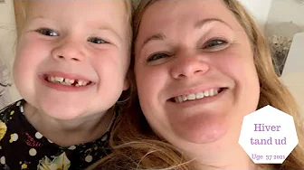 ZOE VIL HAVE AT JEG HIVER HENDES TAND UD