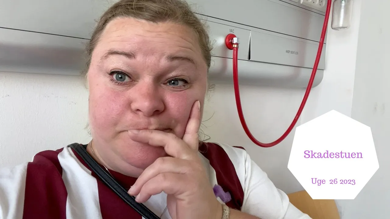 JEG MÅ PÅ SKADESTUEN IMENS VI ER I CIRKUS SUMMARUM