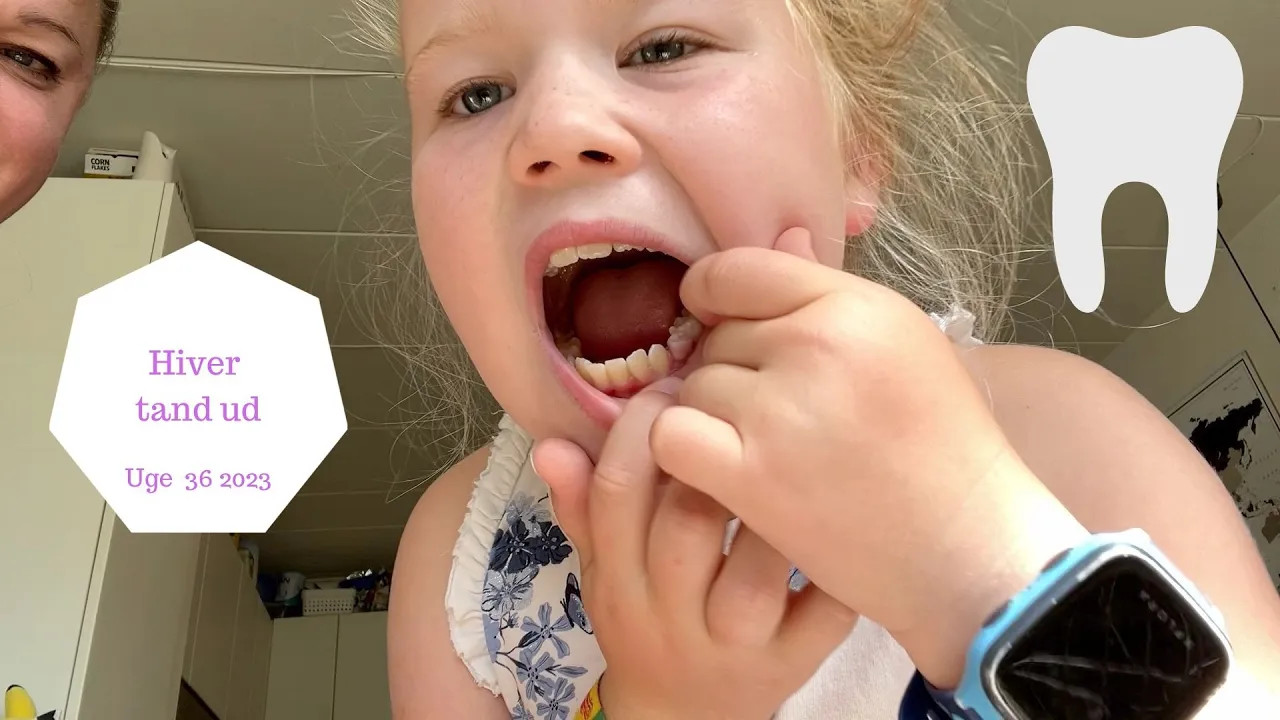 HIVER ZOES TAND UD - KOMMER TANDFEEN?