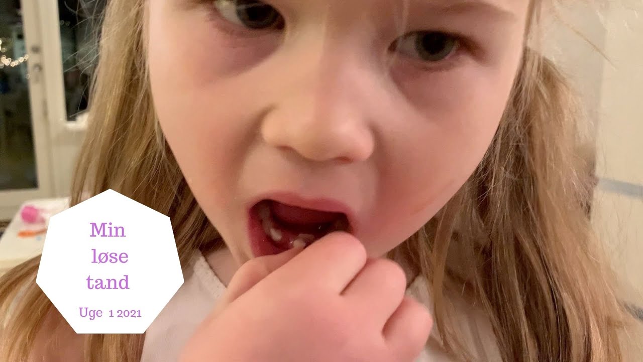 JEG TROR PÅ TANDFEEN - TANDFEEN KOMMER