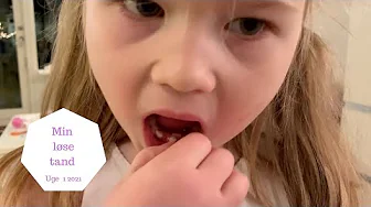 JEG TROR PÅ TANDFEEN - TANDFEEN KOMMER