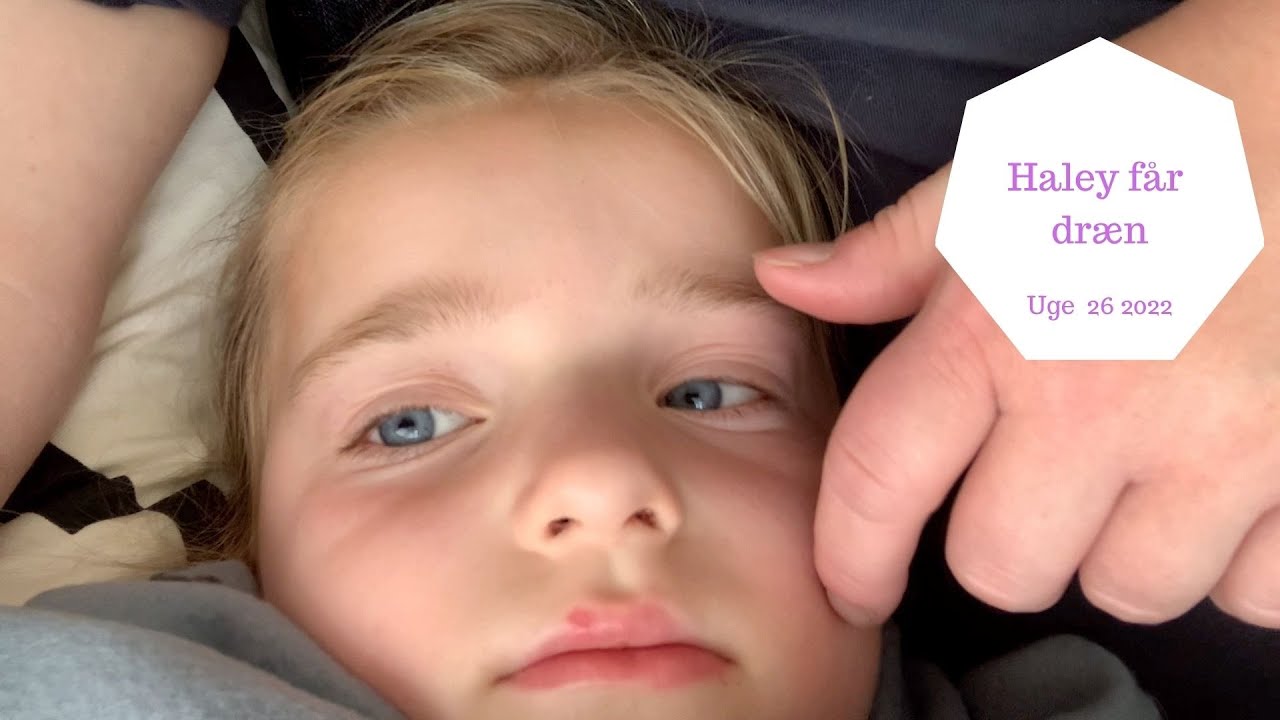 HALEY FÅR LAGT DRÆN OG FJERNET MANGE POLYPPER