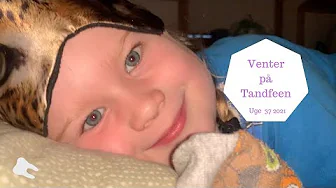 MON TANDFEEN KOMMER I NAT