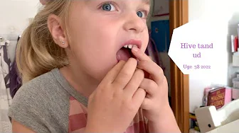 KAN JEG HIVE HALEYS TAND UD?