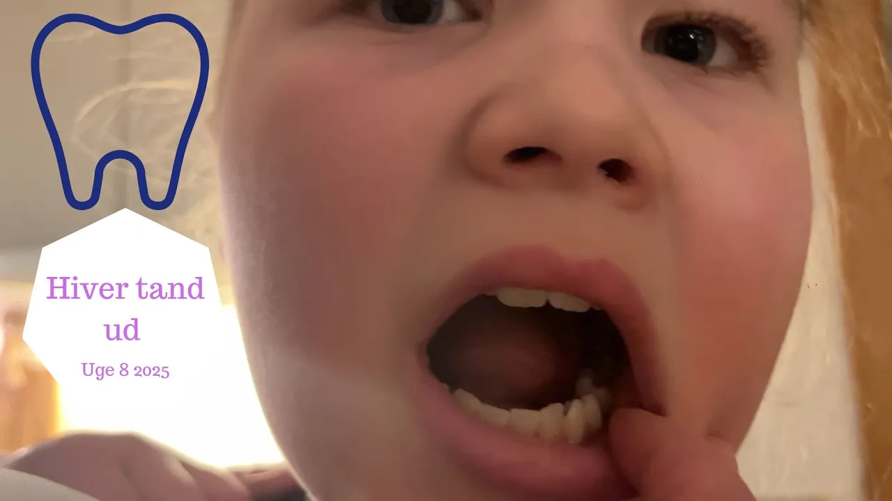 Kommer Hjem fra OSLO - HIVER Zoes Tand ud