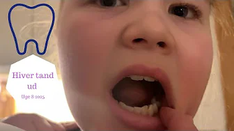 Kommer Hjem fra OSLO - HIVER Zoes Tand ud