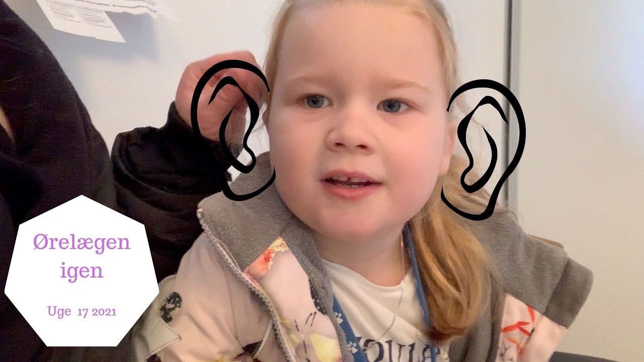 SÅ SKAL VI TIL ØRELÆGERN IGEN