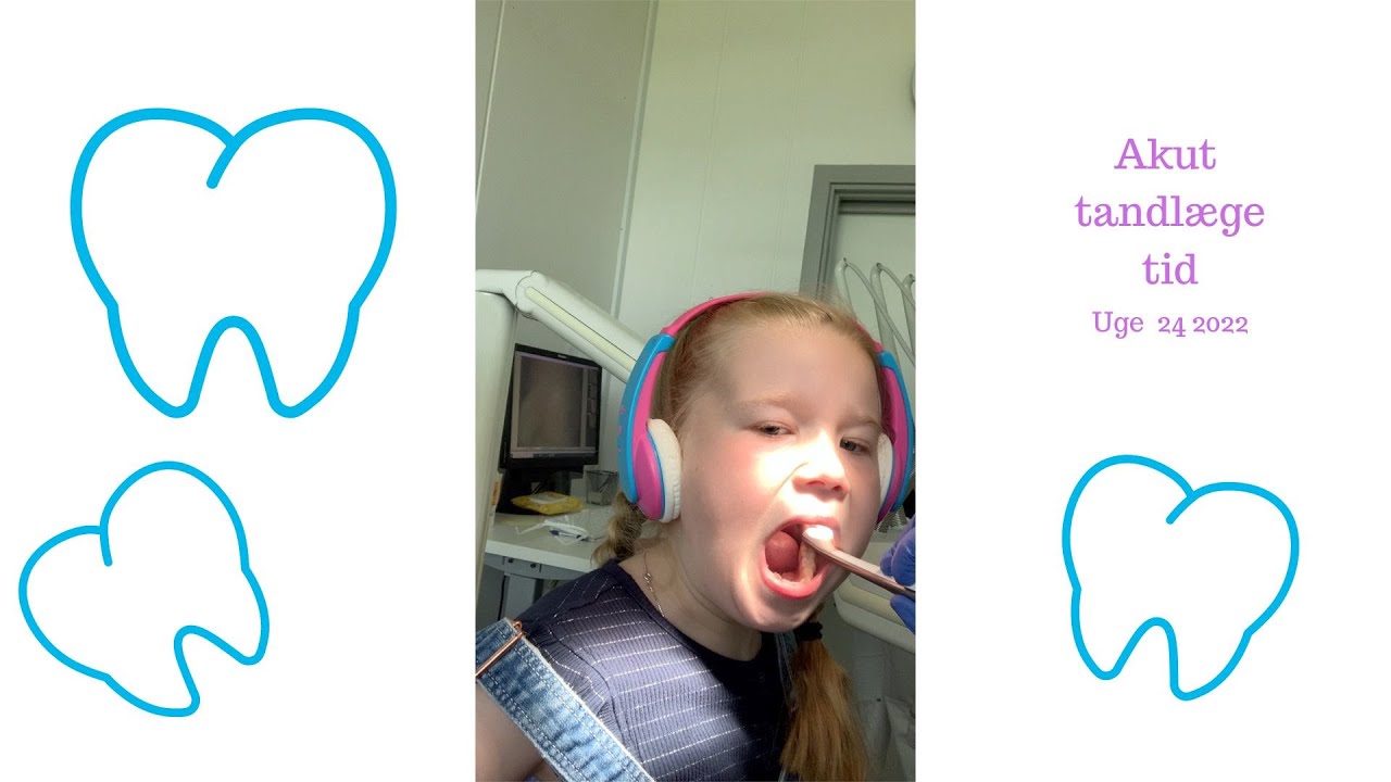 AKUT TANDLÆGE TID, POOL OG TENNIS