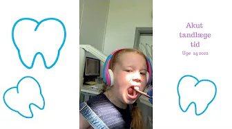 AKUT TANDLÆGE TID, POOL OG TENNIS