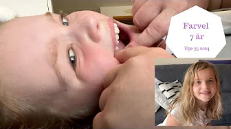 FLÆKKET Tand og Sidste dag som 7 ÅRIG