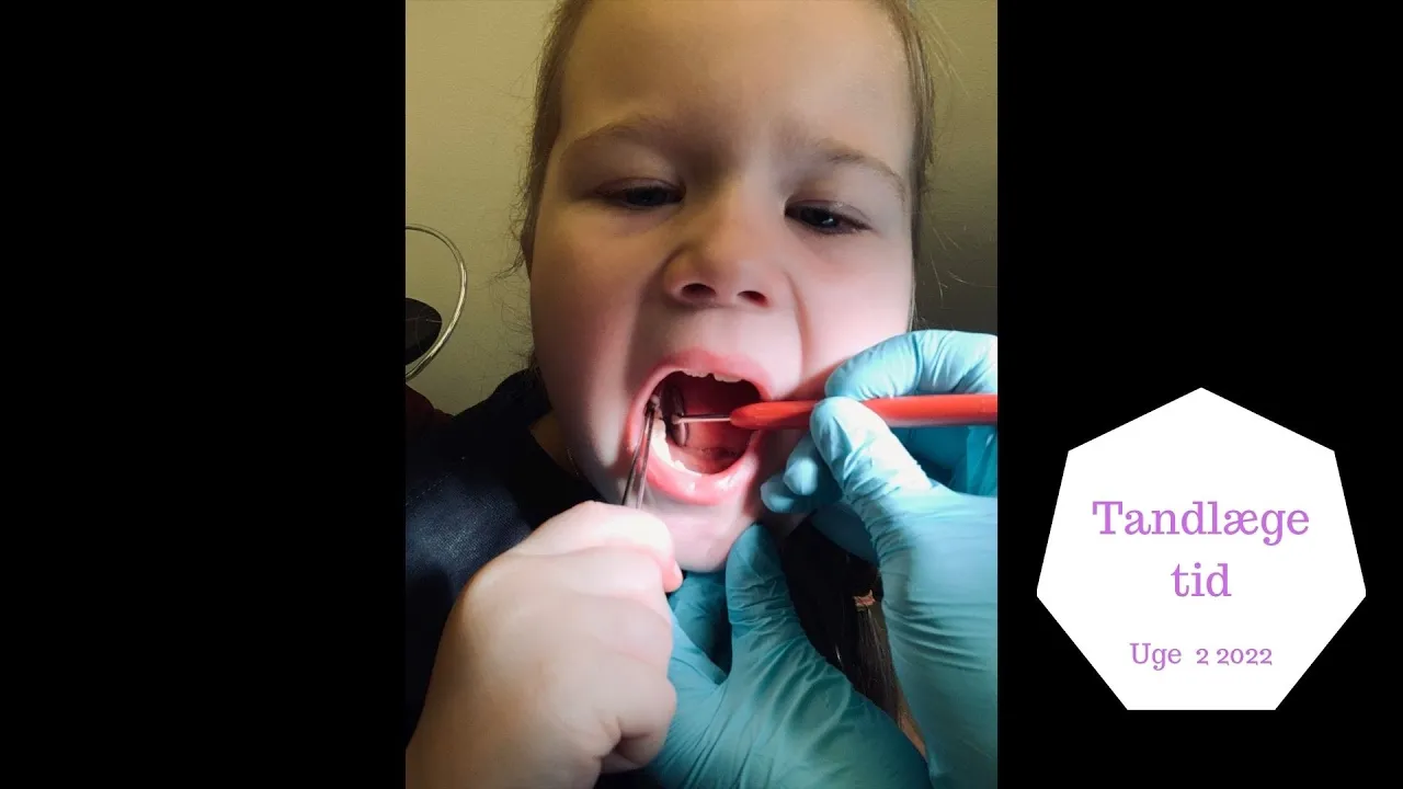 ZOE SKAL TIL TANDLÆGEN - VI PAKKER TIL FERIE