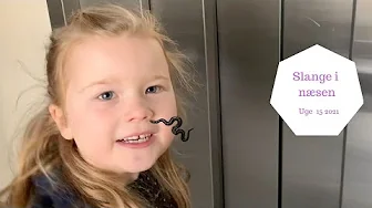 SKAL ZOE HAVE EN SLANGE OP I  NÆSEN