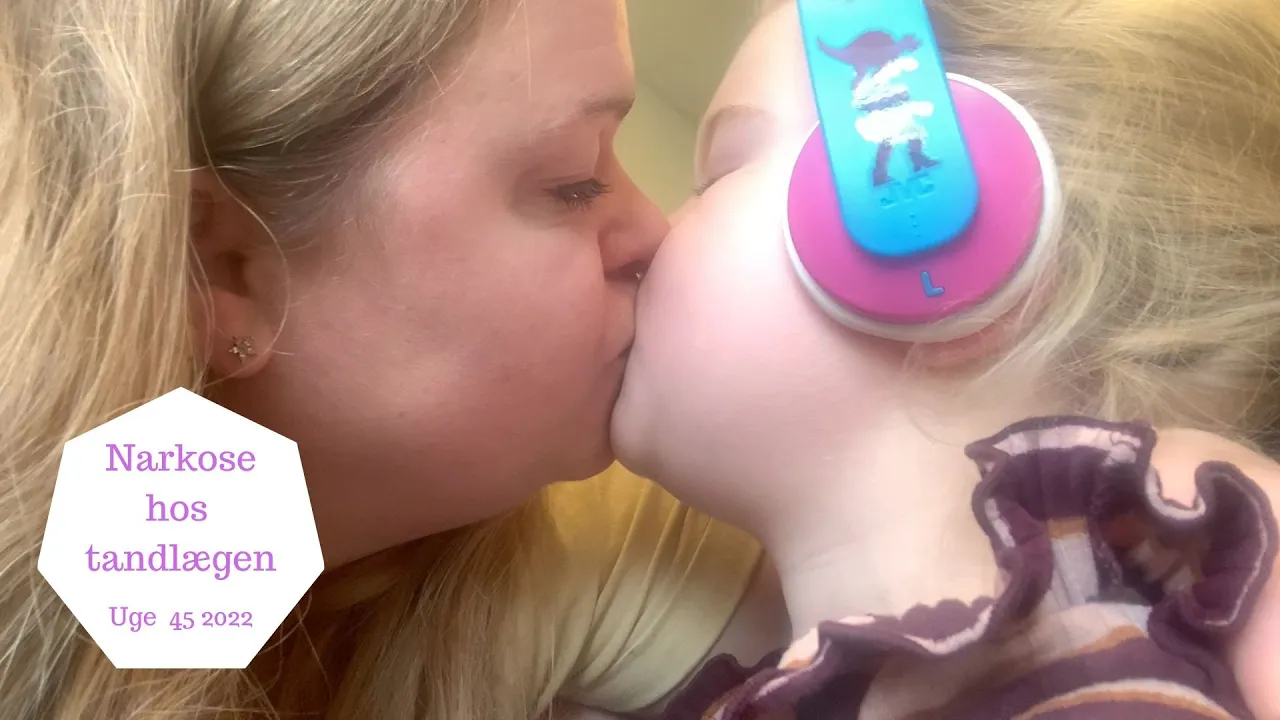 ZOE SKAL I NARKOSE OG HAVE ORDNET TÆNDERNE