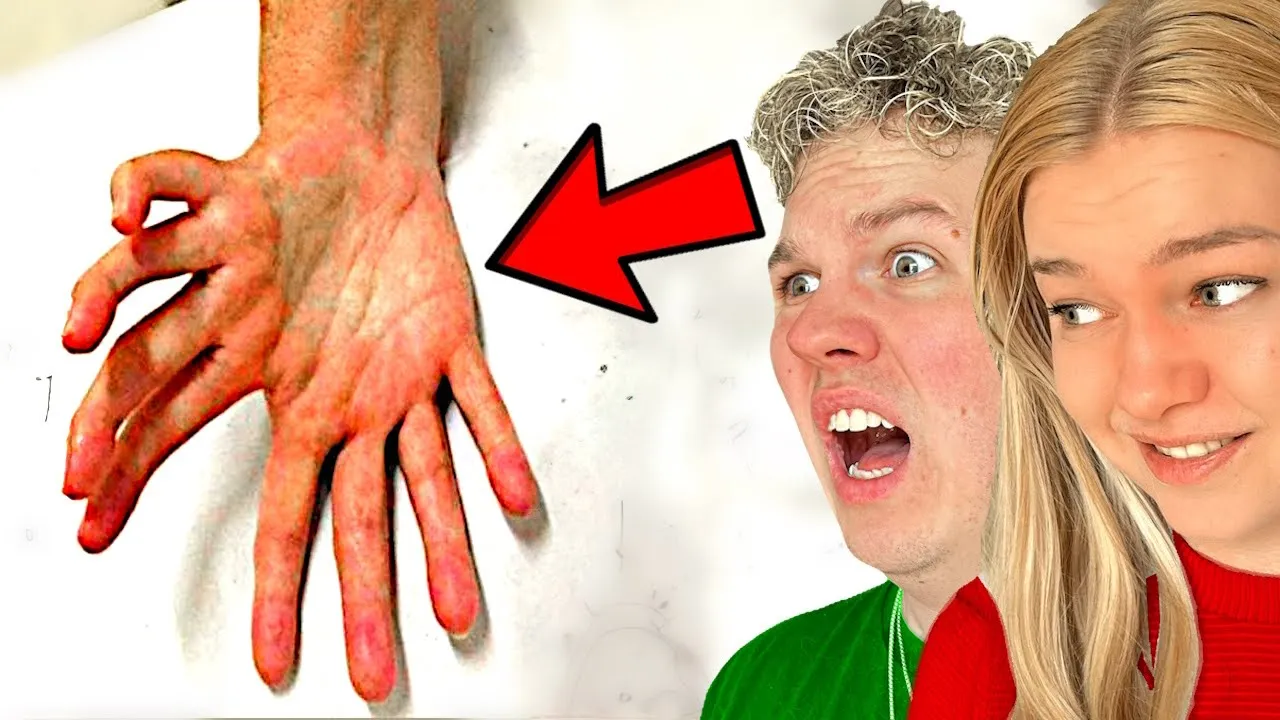 De Mest SJÆLDNE MENNESKER Som Har Levet!