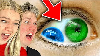 De Mest SJÆLDNE Personer i Verden!