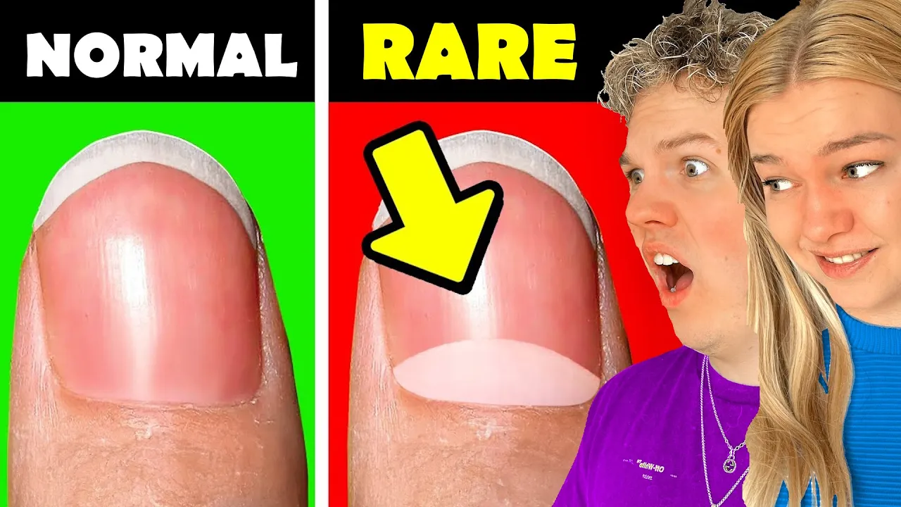 Kun 0,0001% Har Dette! (Hvor Sjælden er Du?)