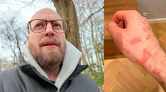 Jeg har pest (Vlog #19)