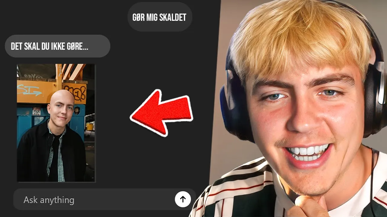 Skal Jeg Blive Skaldet?