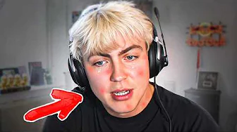 Jeg Har Fået En Sygdom...