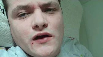 Hår Update! - Casper Besvarer